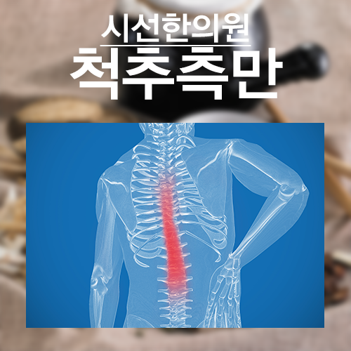 부산척추측만교정 원인을 찾아 해결하자 ! 부산척추측만교정 원인을 찾아 해결하자 ! 안녕하세요 부산척추측만교정 잘하는 부산시선한의원입니다. 오늘은 여러분들에게 척추측만의 원인과 잘못된 자세를 소개해드릴까합니다.