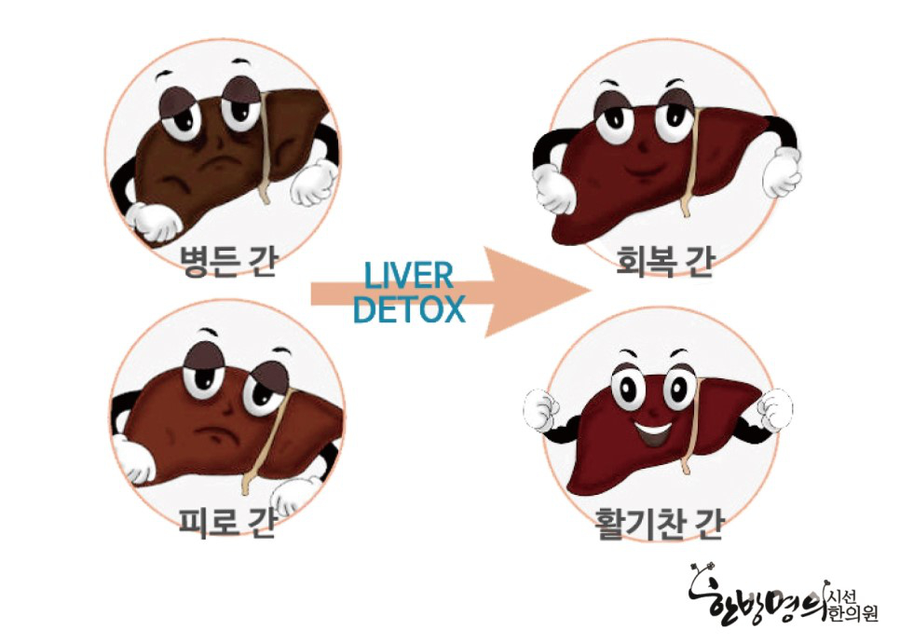 그렇다면 간치유를 반드시 해야할까요? 우리 몸 속에서는 중성지질과 콜레스트롤 등이 엉겨붙어 담관을 막아 간의 독소배출기능을 방해합니다. 그냥 방치할 경우 중풍,고혈압,당뇨,피부질환, ...