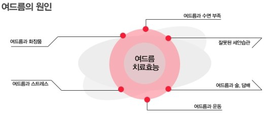 여드름의 원인