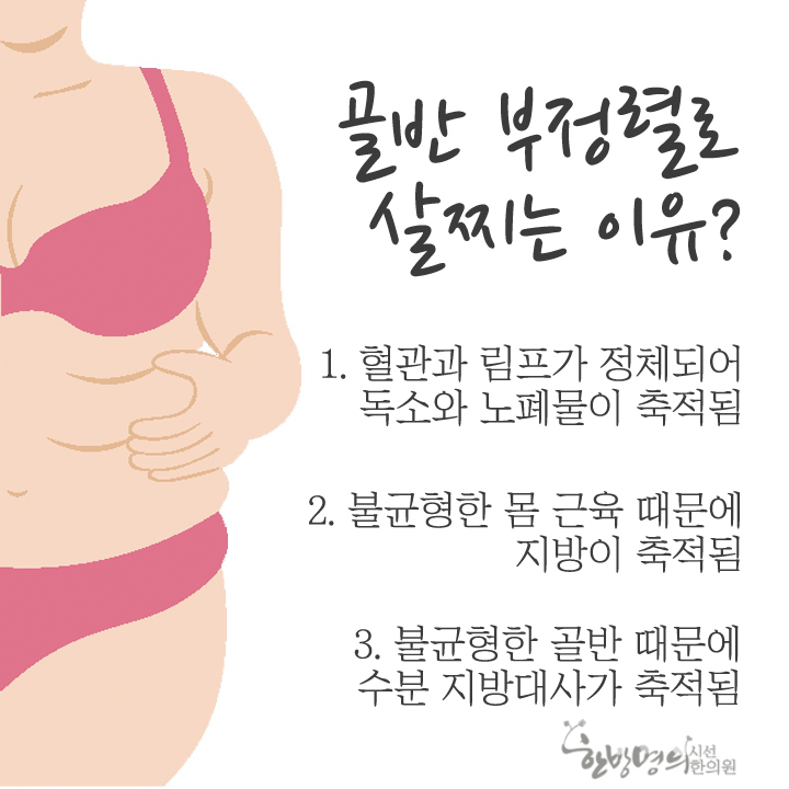 또한 골반 부정렬로 인해 신진대사가 활발하지 못해 혈액순환이 잘 되지않고, 그때문에 몸, 얼굴, 다리 등이 항상 붓고, 또 살도 잘 ...