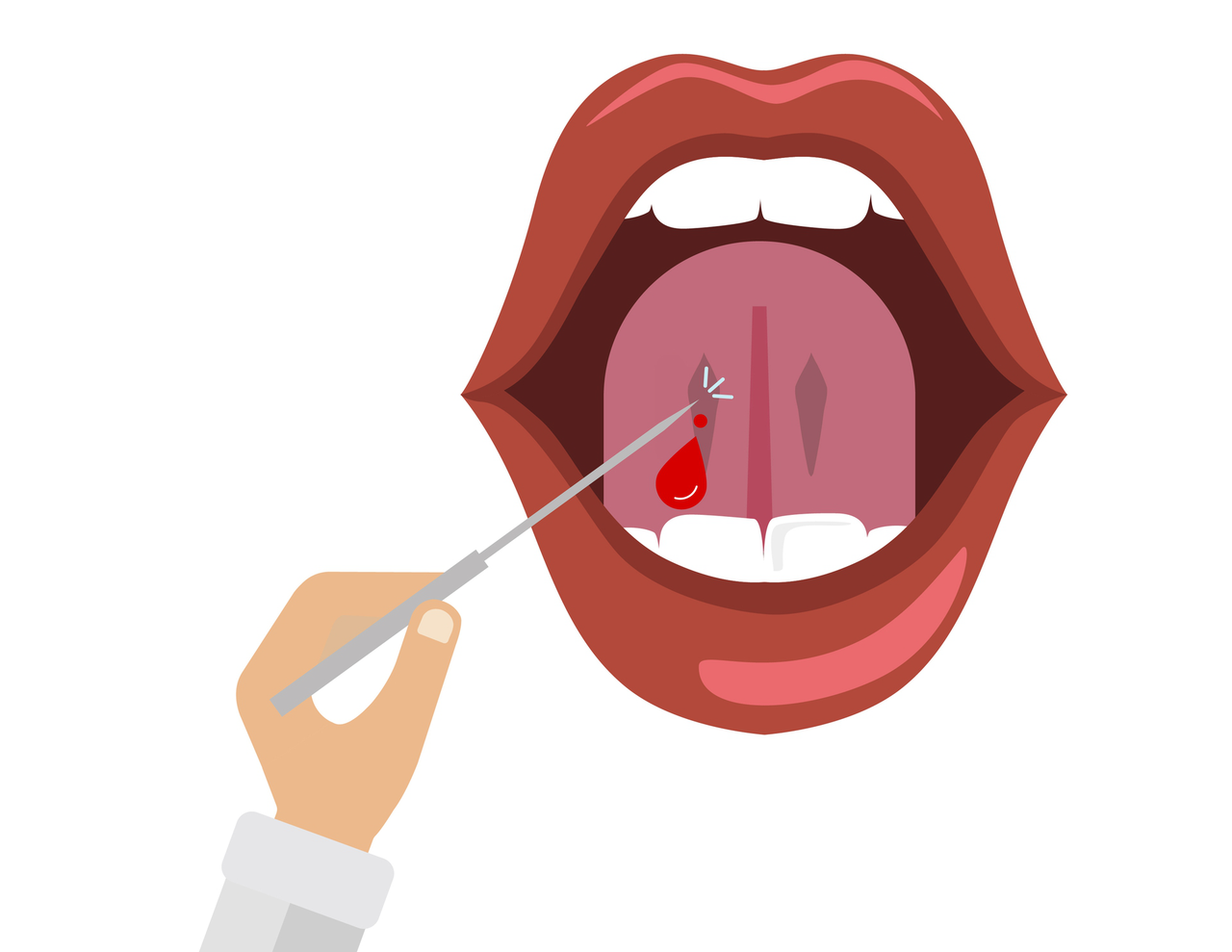 None, [혀밑에서 어혈을 뺀다] 보약보다 가치 있는 선택을 하세요. 바로 혀 밑을 자락하여 어혈을 몸 밖으로 ... | SEASUN Korean Medicine Clinic