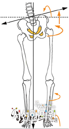 , Sit cross-legged for a long time Scoliosis or bending of legs Passive lifestyle Sleep only ... | SEASUN Korean Medicine Clinic