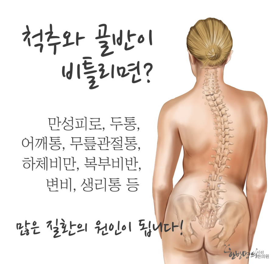 척추와 골반이 비틀리면 다리도 비틀리면서 다리길이가 짧아지기도하고 두 다리 길이가 짝짝이가 되기도 하지요. 이렇게 다리부터 짝짝이가되면 몸의 균형이 맞지않게 되어 ...